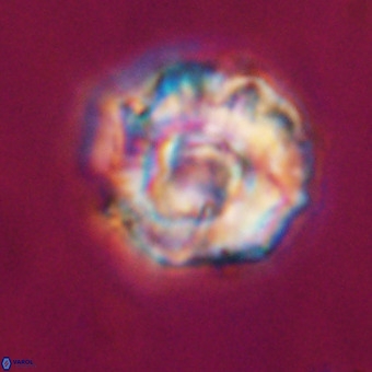 Perchnielsenella stradneri VR 22538