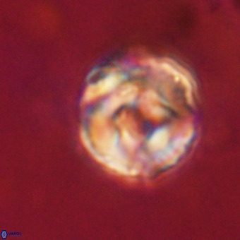 Perchnielsenella stradneri VR 22600