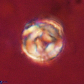 Perchnielsenella stradneri VR 22601
