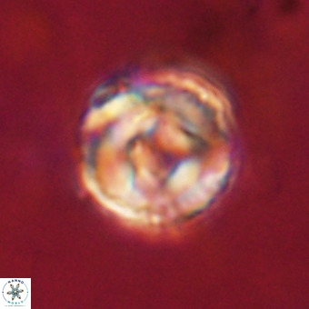 Perchnielsenella stradneri VR 22601