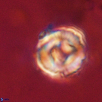 Perchnielsenella stradneri VR 22606
