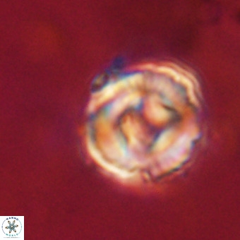 Perchnielsenella stradneri VR 22606