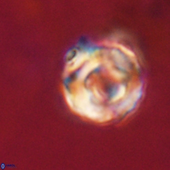 Perchnielsenella stradneri VR 22607