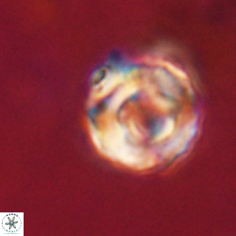 Perchnielsenella stradneri VR 22607