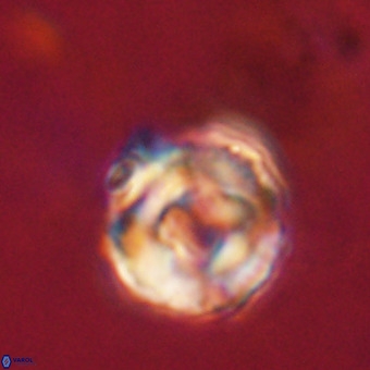Perchnielsenella stradneri VR 22608