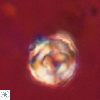 Perchnielsenella stradneri VR 22608