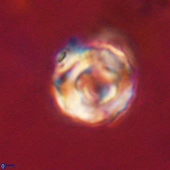 Perchnielsenella stradneri VR 22609
