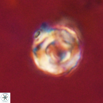 Perchnielsenella stradneri VR 22609