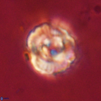 Perchnielsenella stradneri VR 22615