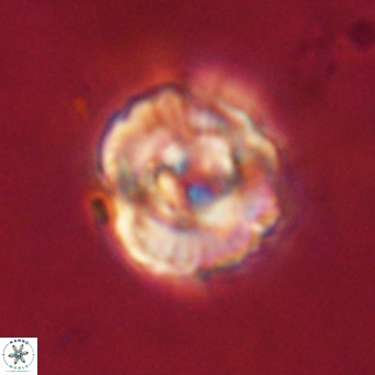 Perchnielsenella stradneri VR 22615