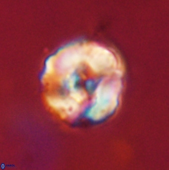 Perchnielsenella stradneri VR 22616