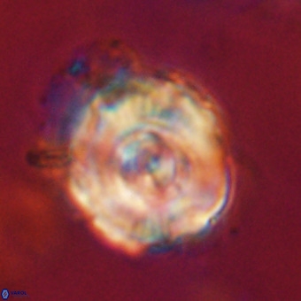 Perchnielsenella stradneri VR 22704
