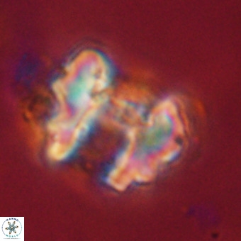 Perchnielsenella stradneri VR 22708