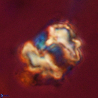 Perchnielsenella stradneri VR 22718