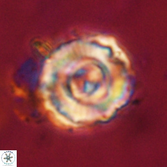 Perchnielsenella stradneri VR 22724