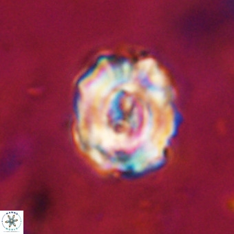 Perchnielsenella stradneri VR 22844