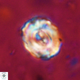 Perchnielsenella stradneri VR 22845