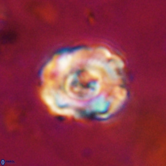 Perchnielsenella stradneri VR 22851