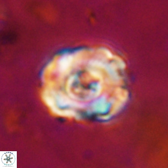 Perchnielsenella stradneri VR 22851