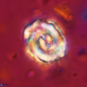 Perchnielsenella stradneri VR 22855