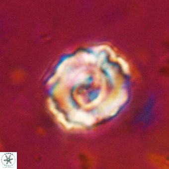 Perchnielsenella stradneri VR 22859