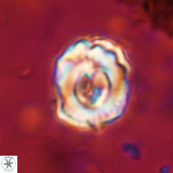Perchnielsenella stradneri VR 22863