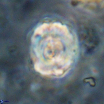 Perchnielsenella stradneri VR 22865