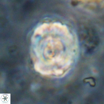 Perchnielsenella stradneri VR 22865