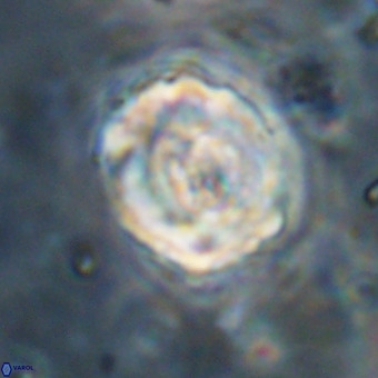 Perchnielsenella stradneri VR 22866