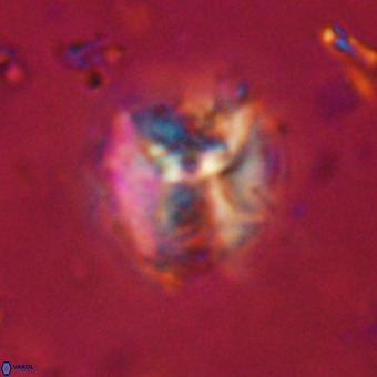 Perchnielsenella stradneri VR 22834