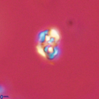 Perideraiolithos seherae 59085