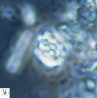 Perideraiolithus ponticus 25978