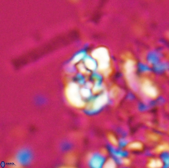 Perideraiolithus ponticus 25971