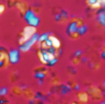 Perideraiolithus ponticus 23425