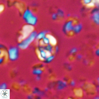Perideraiolithus ponticus 23425
