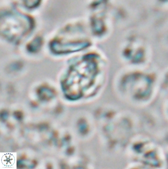 Perideraiolithus ponticus 23430