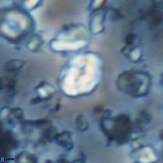 Perideraiolithus ponticus 23431