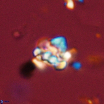 Perideraiolithus ponticus 59104