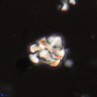 Perideraiolithus ponticus 59102