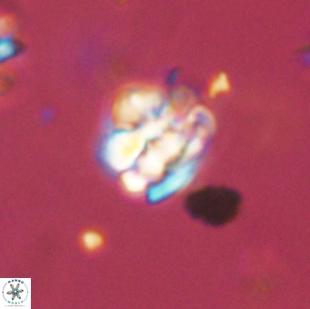 Perideraiolithus ponticus 59115