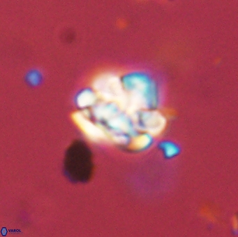 Perideraiolithus ponticus 59116