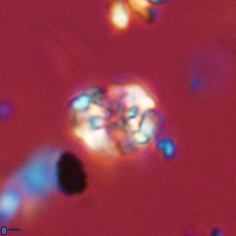 Perideraiolithus ponticus 59125