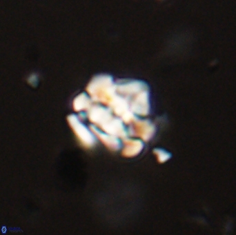 Perideraiolithus ponticus 59120