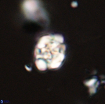 Perideraiolithus ponticus 59131