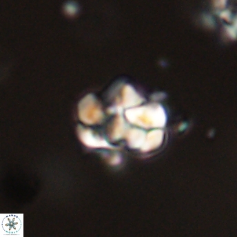 Perideraiolithus ponticus 59147