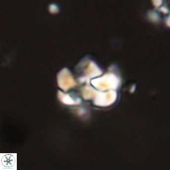 Perideraiolithus ponticus 59148