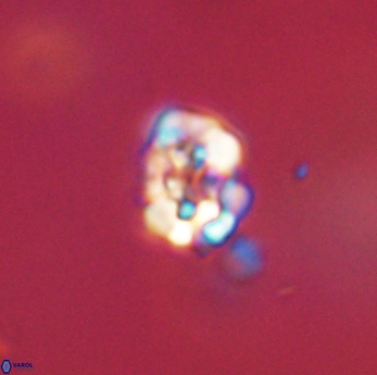 Perideraiolithus ponticus 59166