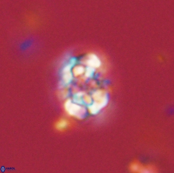 Perideraiolithus ponticus 59170