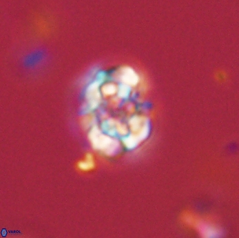 Perideraiolithus ponticus 59171