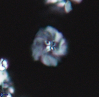 Pickelhaube umbellatum 11645